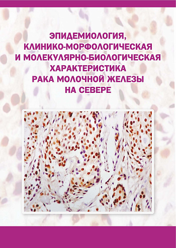 Эпидемиология, клинико-морфологическая и молекулярно-биологическая характеристика рака молочной железы на Севере